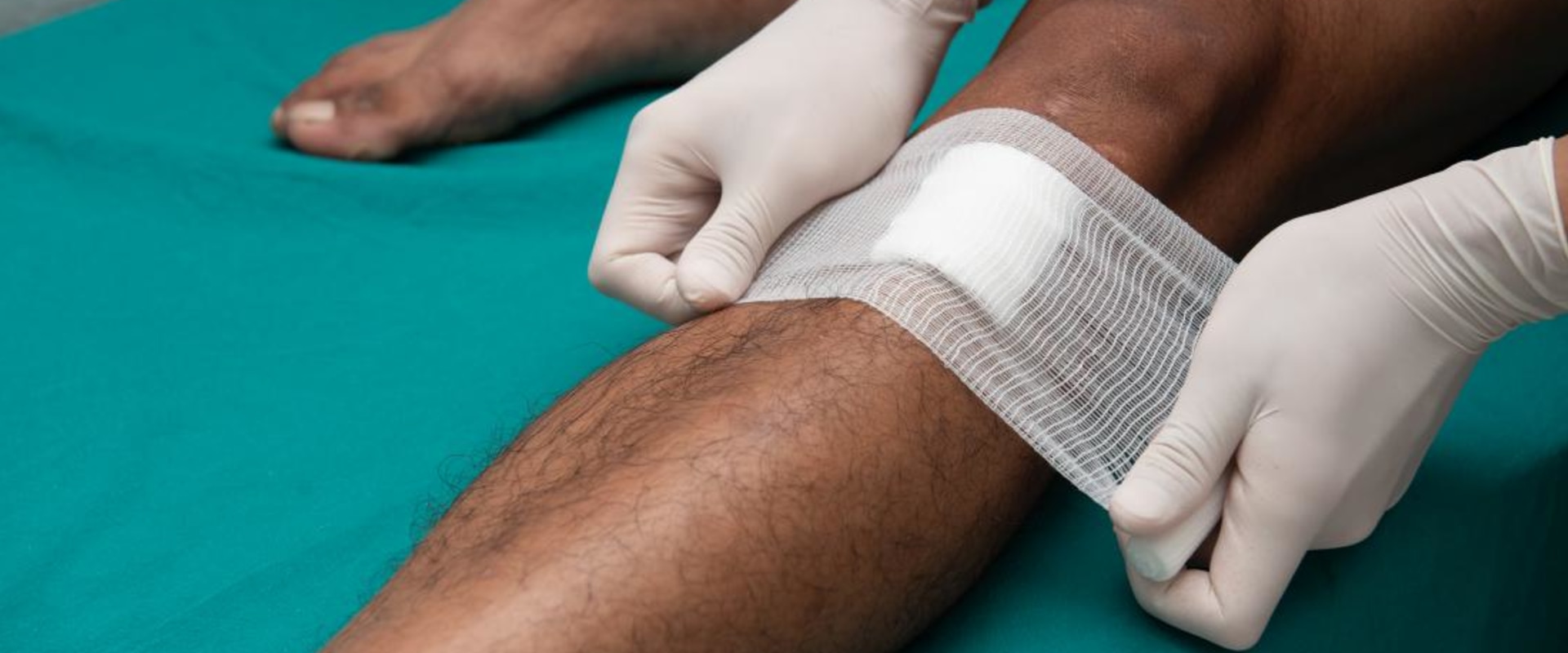 The Healing Process: How to Properly Cover Wounds for Optimal Recovery