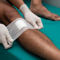 The Healing Process: How to Properly Cover Wounds for Optimal Recovery