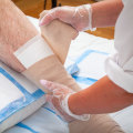 The Importance of Proper Wound Care for Ulcers: An Expert's Perspective