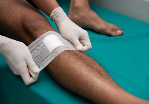 The Healing Process: How to Properly Cover Wounds for Optimal Recovery