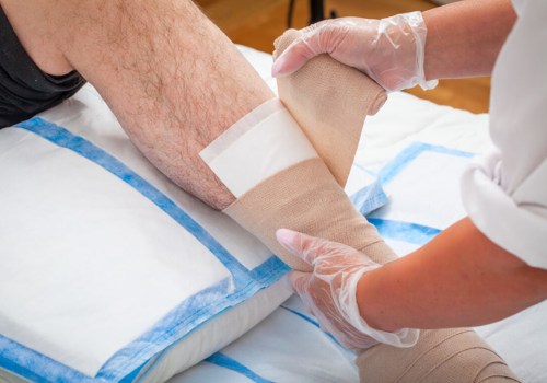 The Importance of Proper Wound Care for Ulcers: An Expert's Perspective